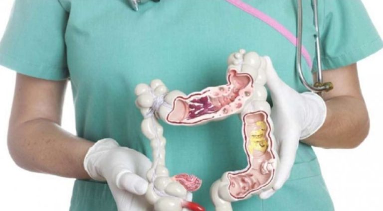 Rriten rastet e kancerit tek të rinjtë, mjekët: Shkak është stili i jetesës