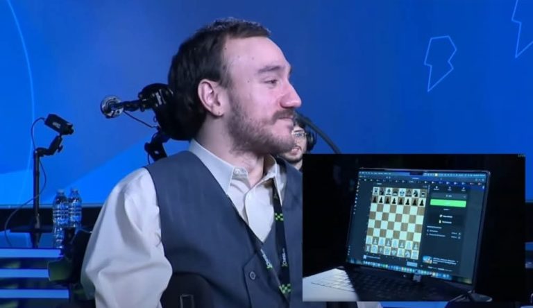 Njeriu me një çip që lexon mendjen – falë Elon Musk-ut