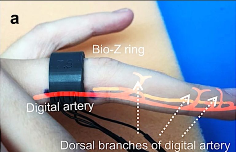 Unaza që ndihmon shurdhmemecët të komunikojnë pa kufizime