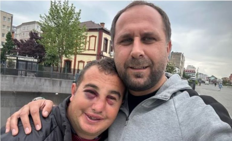 Sulmohet një person me aftësi të kufizuara në Ferizaj