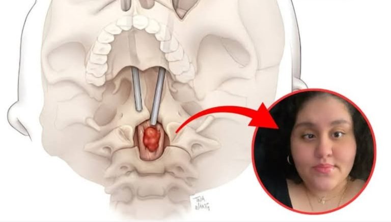 Hapi i madh në Neurokirurgji: Operacioni unik që ndryshoi historinë e mjekësisë