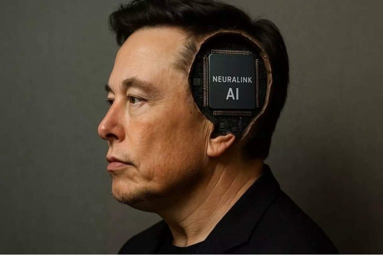 18 muaj pas implantit me çip në tru, pacienti i Neuralink të Elon Musk ndan përjetimet e tij