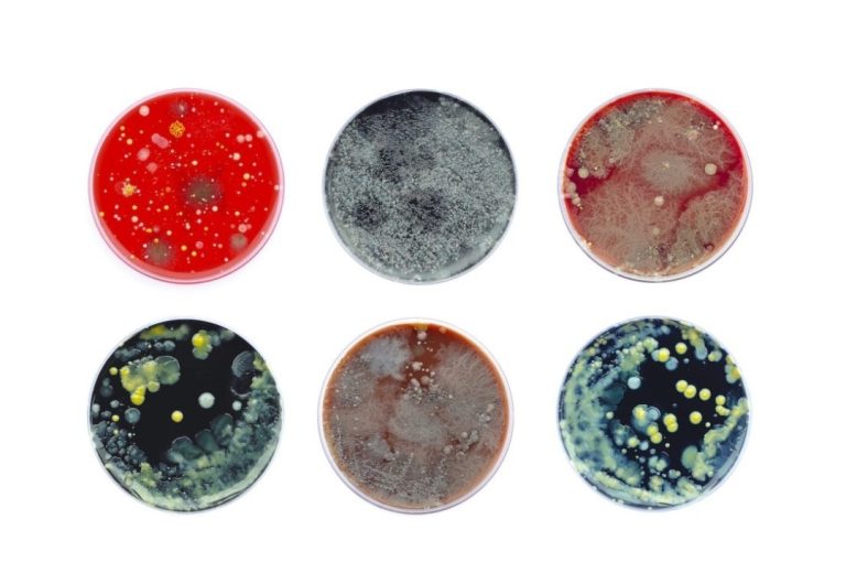 Rreziku i rezistencës ndaj antimikrobialëve po kërcënon shëndetin e kafshëve dhe njerëzve