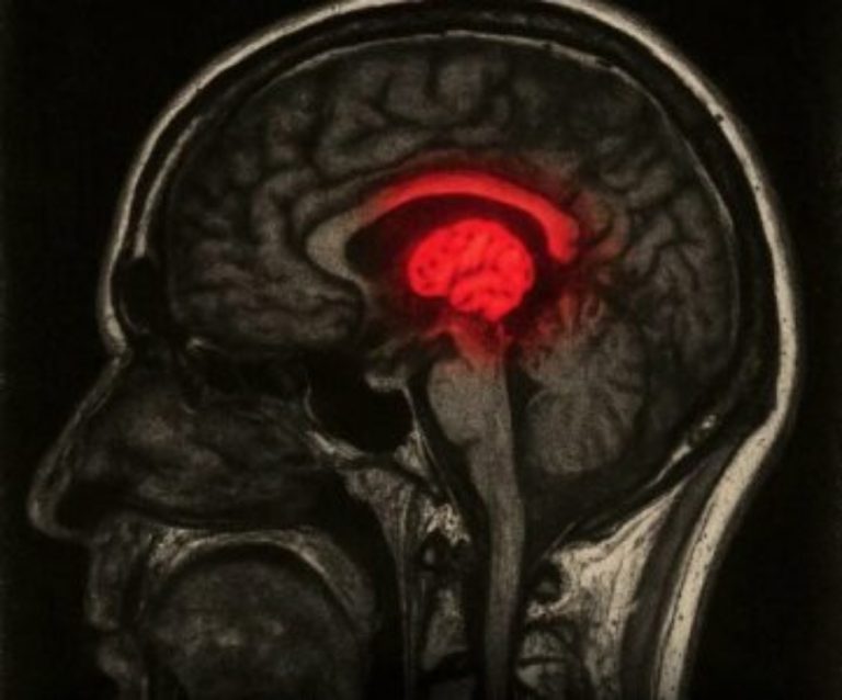 Shkencëtarët: TikTok po tkurr trurin dhe shkatërron përqendrimin