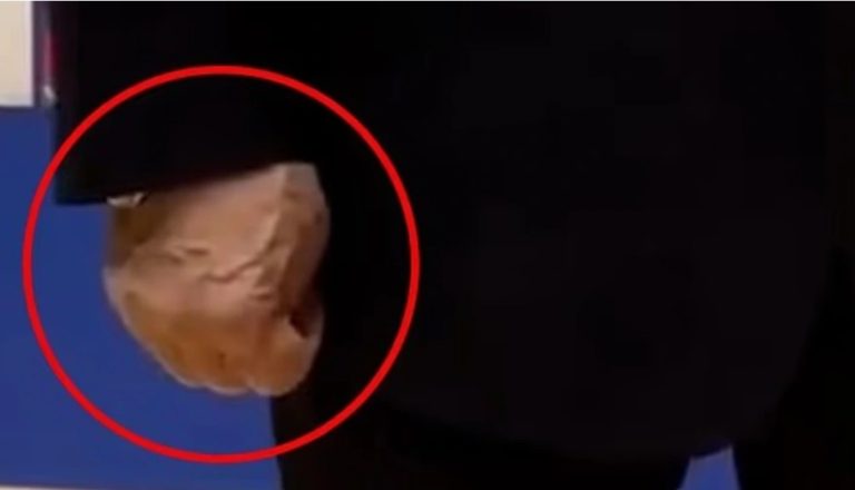 Venat e fryra në dorë ngjallin spekulime të reja për shëndetin e Putin