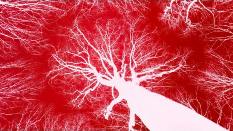 Studiuesit krijojnë mikrorobotë që notojnë në gjak për të parandaluar goditje në tru