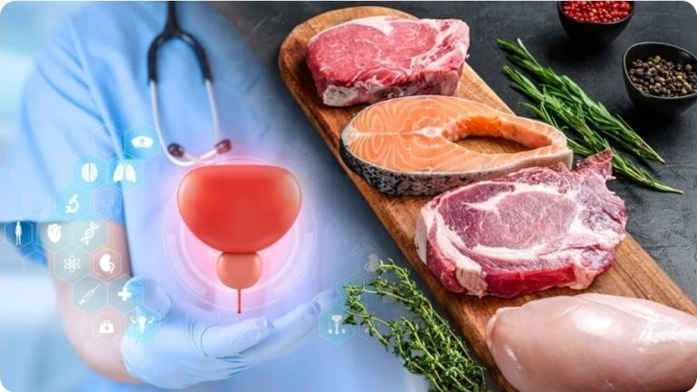 Studimi i ri: Si ndikon dieta para dhe pas diagnozës së kancerit të prostatës në jetëgjatësi