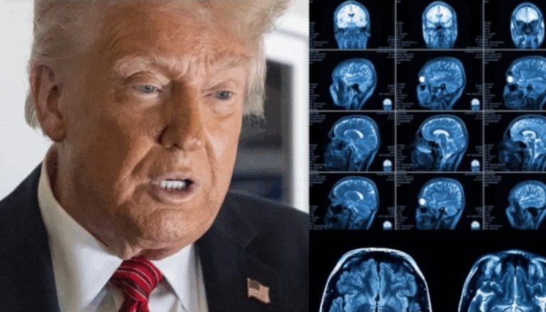 Trump i nënshtrohet një skanimi MRI, ngrit pyetje mbi shëndetin e tij