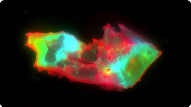 Zbulohen struktura mikroskopike të pazakonta në gjakun e pacientëve me COVID të zgjatur