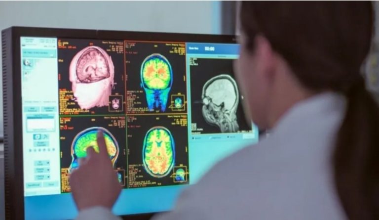 Adoleshenca zgjat deri në të 30-at, studimi i ri identifikon katër mosha kyçe të zhvillimit të trurit